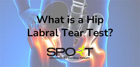 labral tear test results